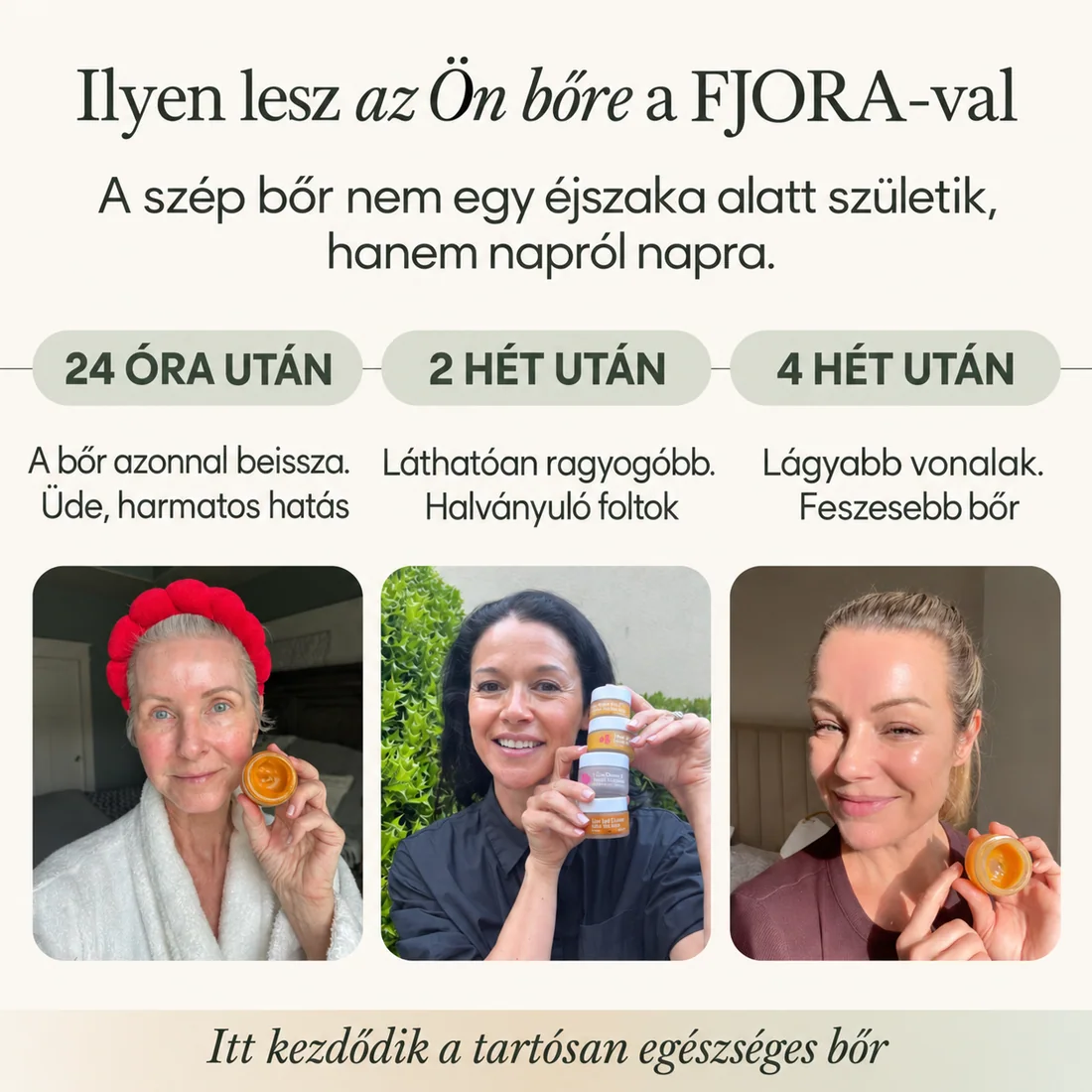 FJORA Organics teljes bőrápoló rendszer érett bőrre – eredmények idővonala 24 óra, 2 és 4 hét után