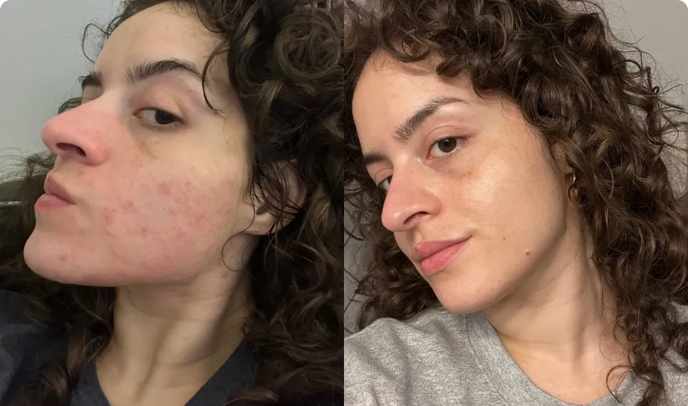 Camille, 33