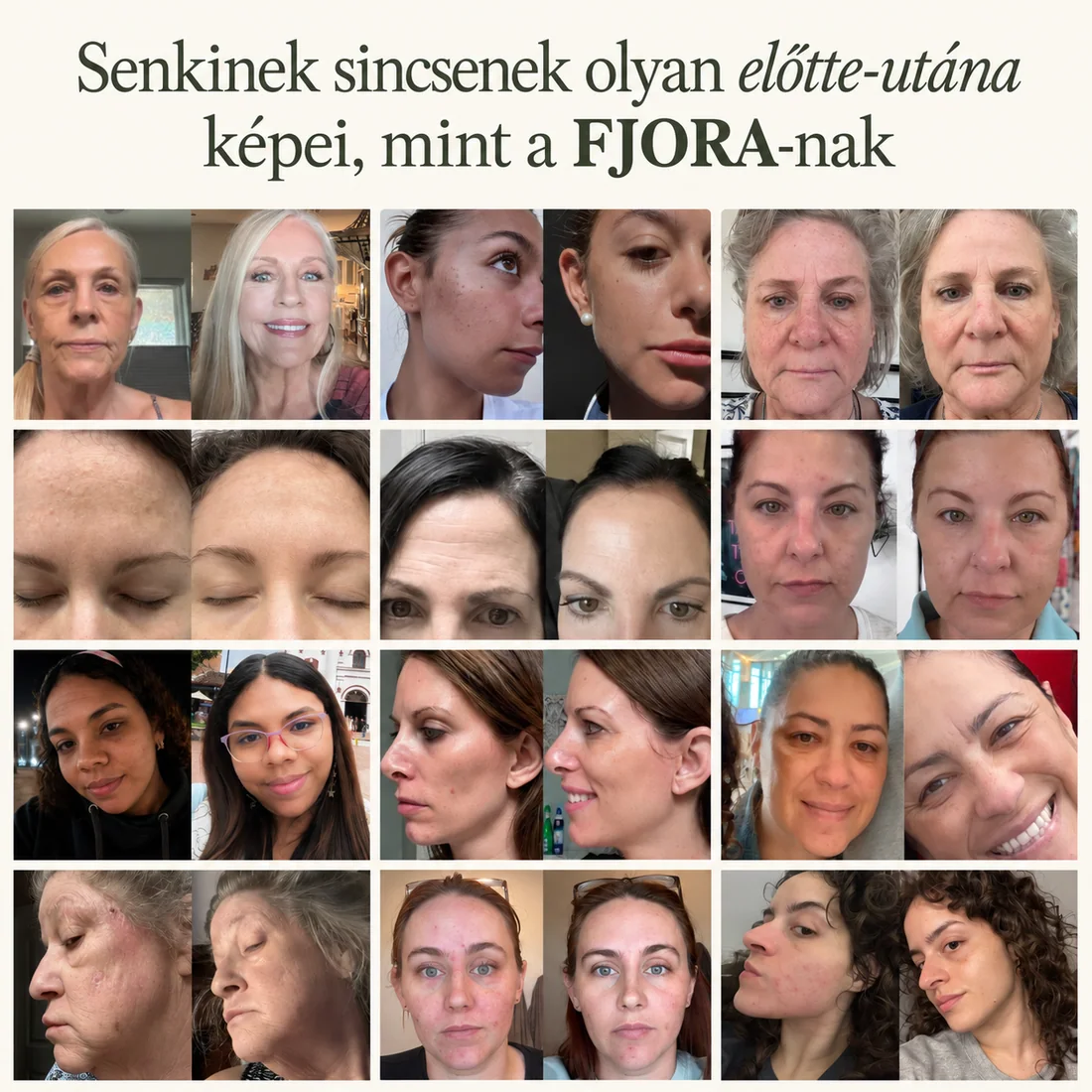 FJORA Organics teljes bőrápoló rendszer érett bőrre – vásárlói előtte-utána eredmények rácsban